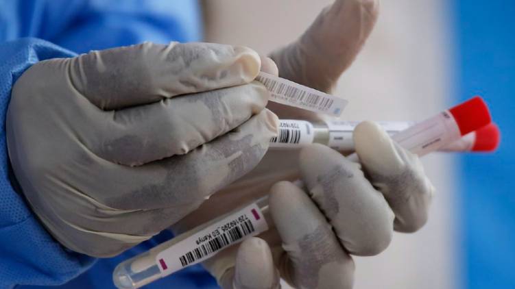 covid 19 coronavirus ernakulam