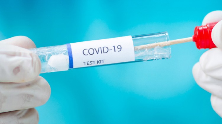 64789 covid samples tested