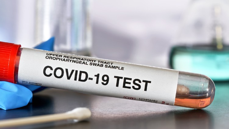 covid positivity ration kerala