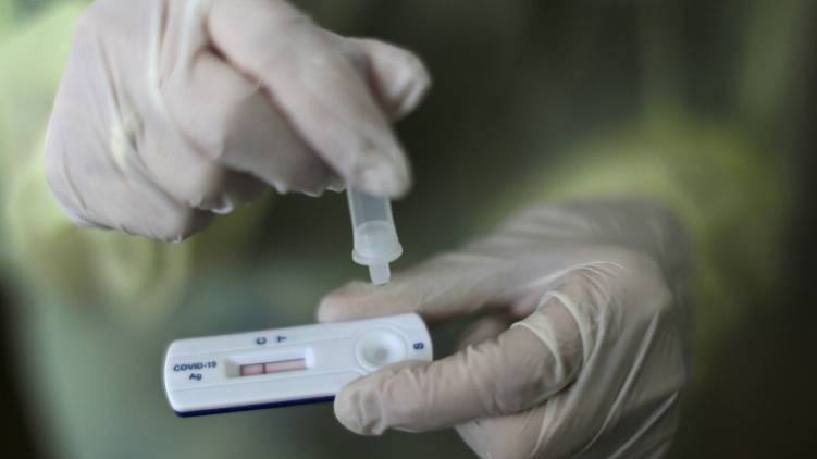govt bought antigen test are poor quality