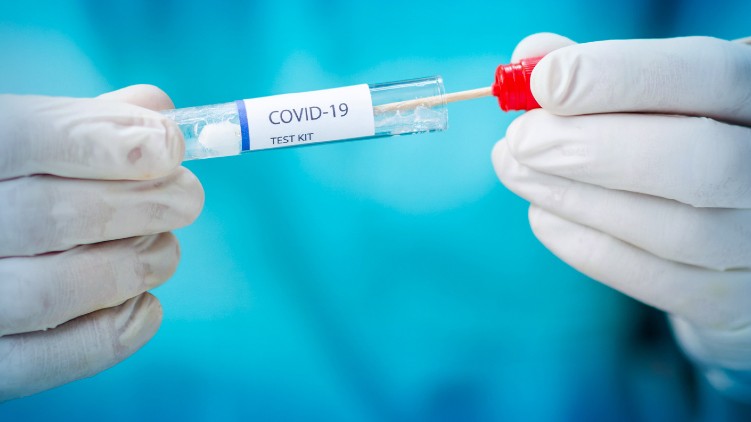 Covid testing labs reduced