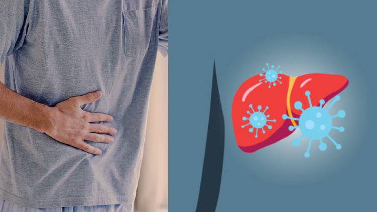 hepatitis symptoms treatment