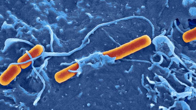 second shigella reported in ernakulam