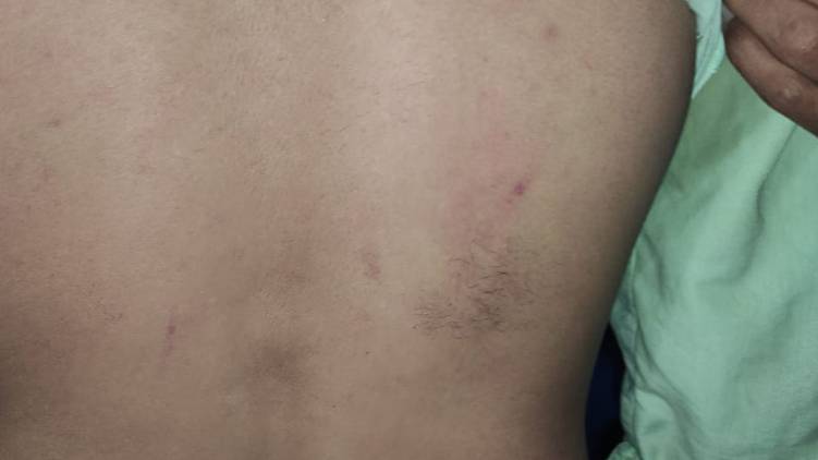thiruvananthapuram youth manhandled by excise team