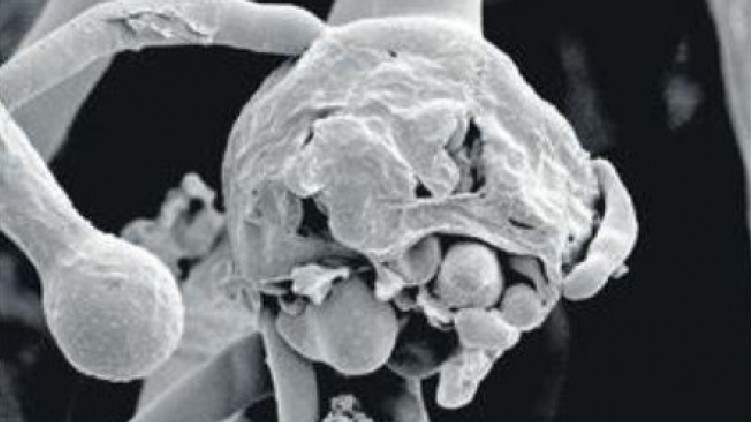 black fungus death kerala