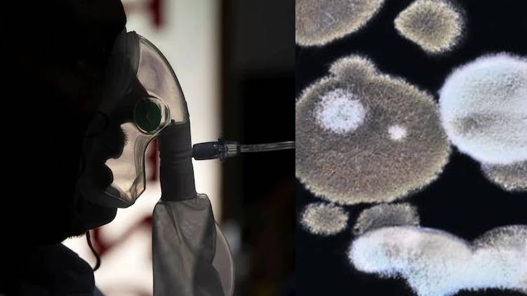 cm confirms black fungus presence in kerala