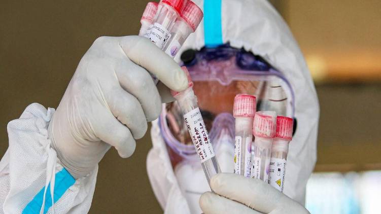 lab owners approach hc against rtpcr rate