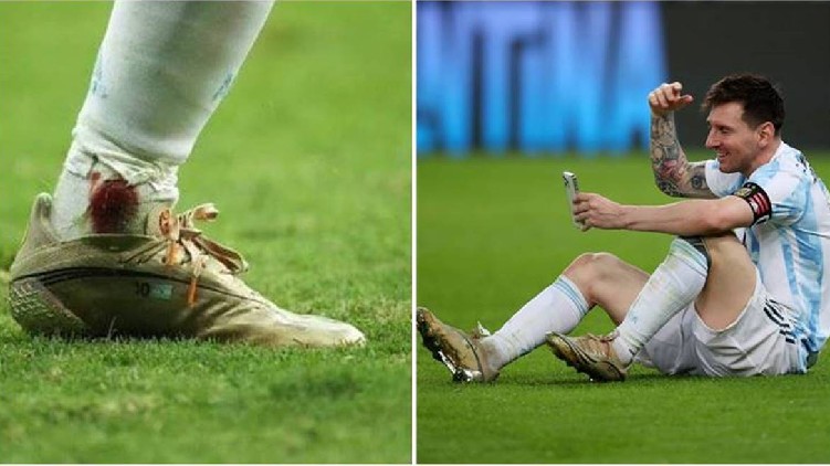 messi Copa final injury’