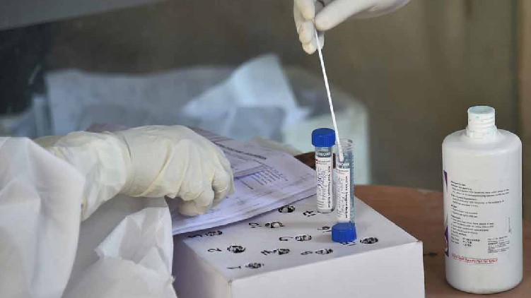 antigen test