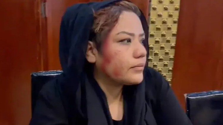 Afghan woman beaten Taliban