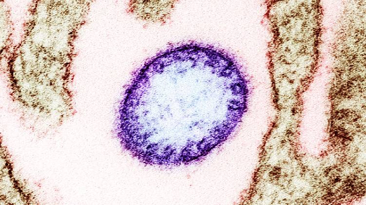 nipah virus negative