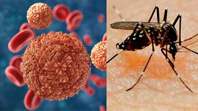 kozhikode woman suspects zika