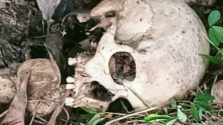 thiruvananthapuram skeleton found