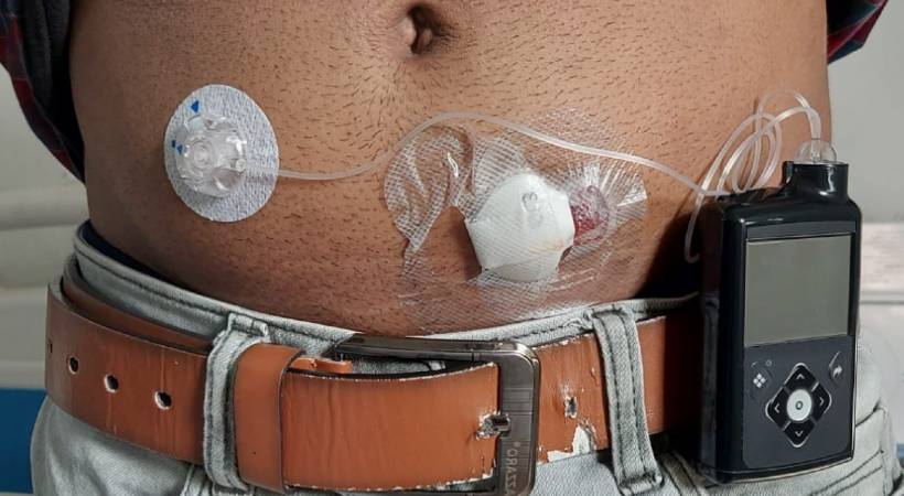 artificial pancreases in india