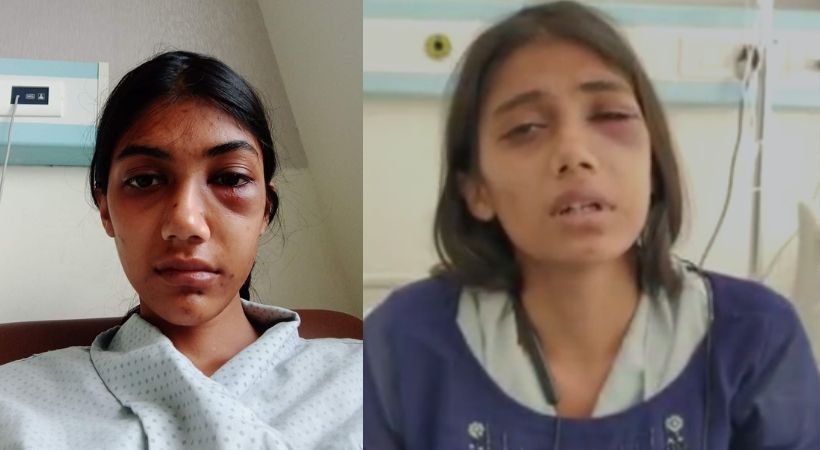 Woman brutally beaten