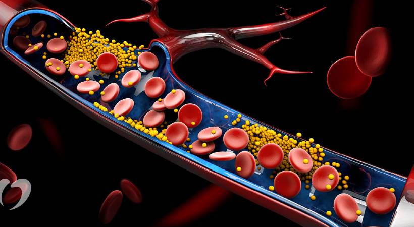 cholesterol control foods