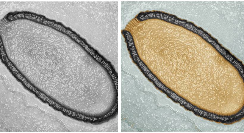 zombie virus grips canada