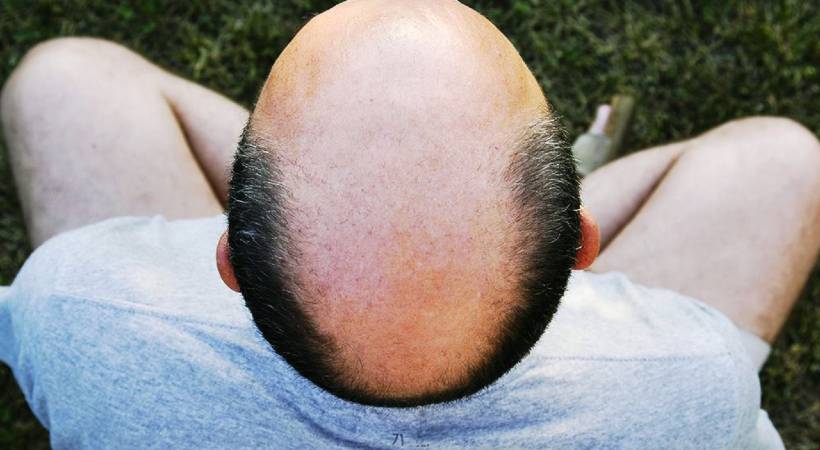bald is sexual harassment