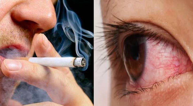 smoking