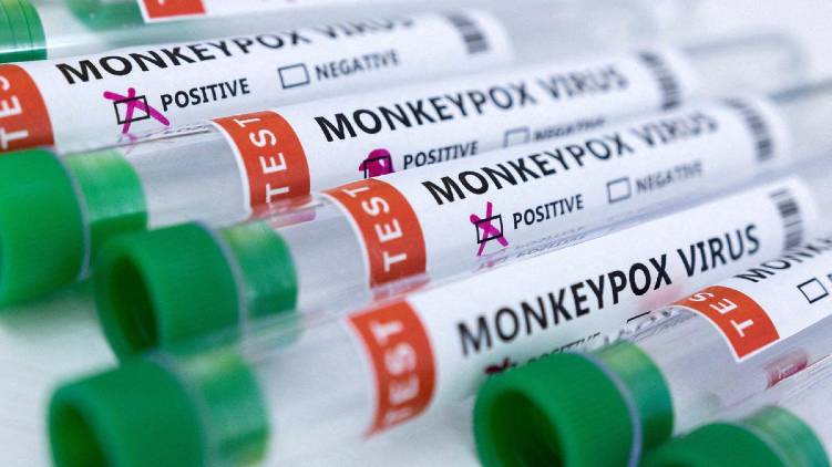 Two persons monkeypox observation