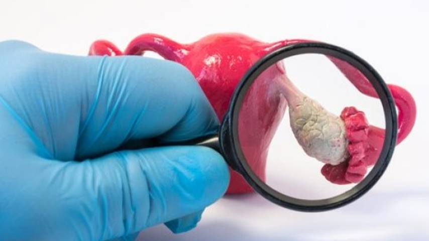 How to detect ovarian cysts