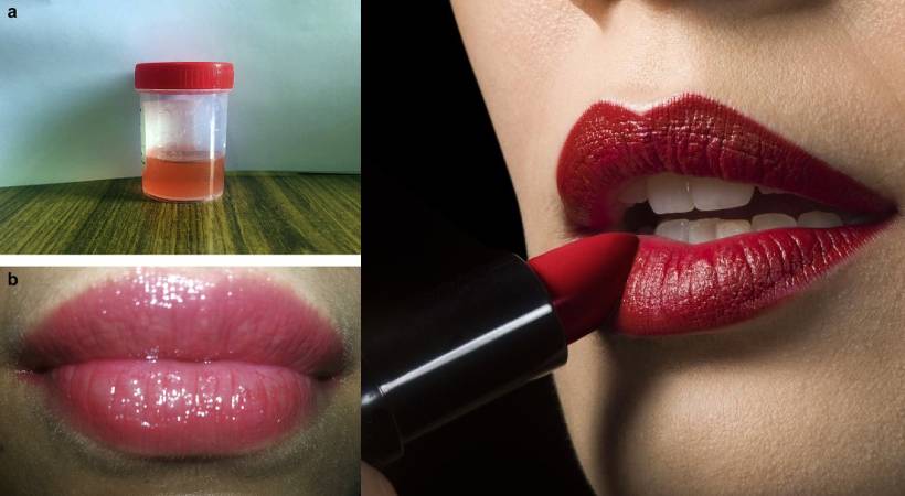 Can the colour of urine turn red if you use lipstick
