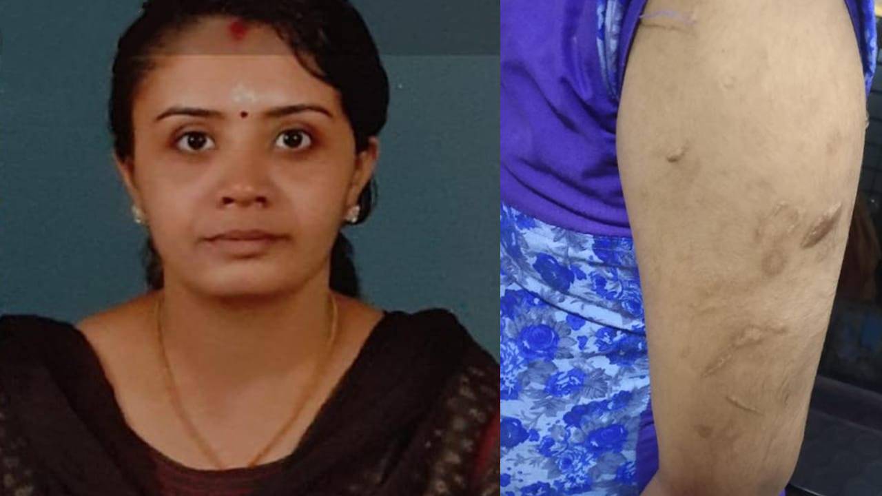 brutally beaten; Stepmother in remand