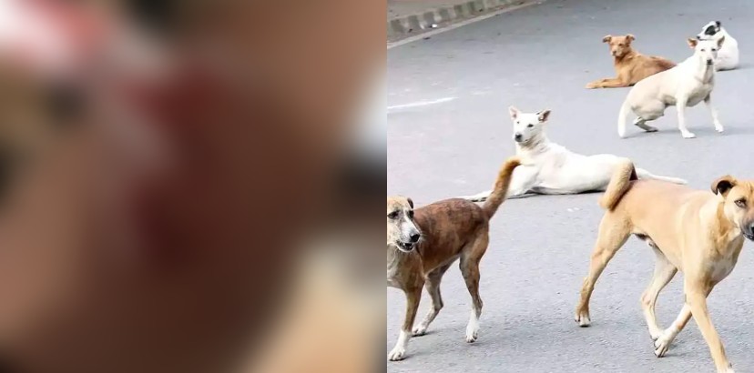 stray dog attack in kozhikode 4 injured