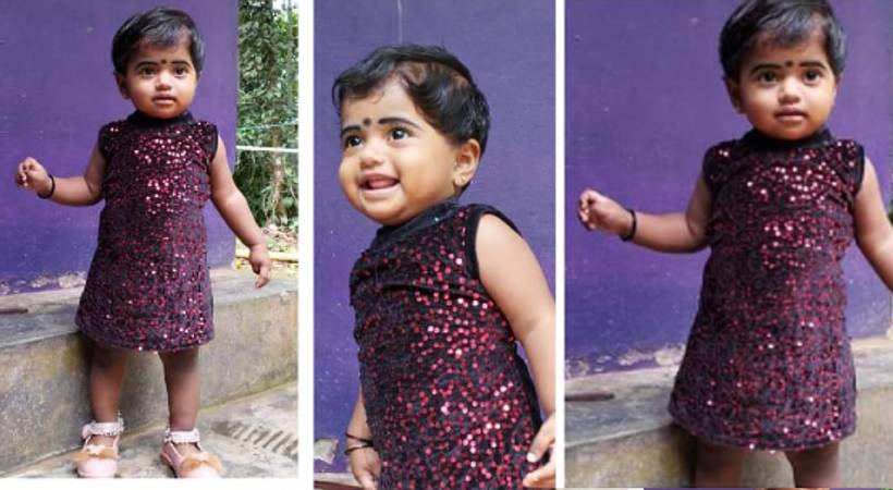 little girl died of burns