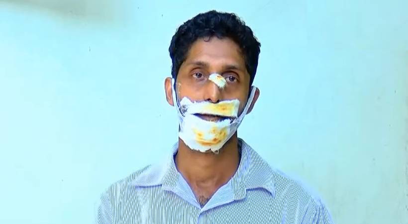 differently abled man attacked by stray dog