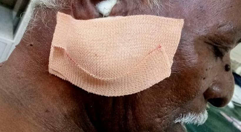 fort kochi fishermen got shot