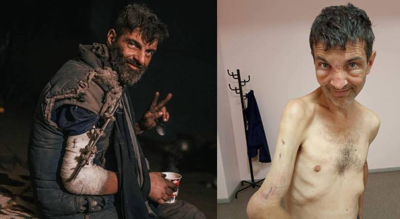 Ukraine soldier before and after Russian captivity
