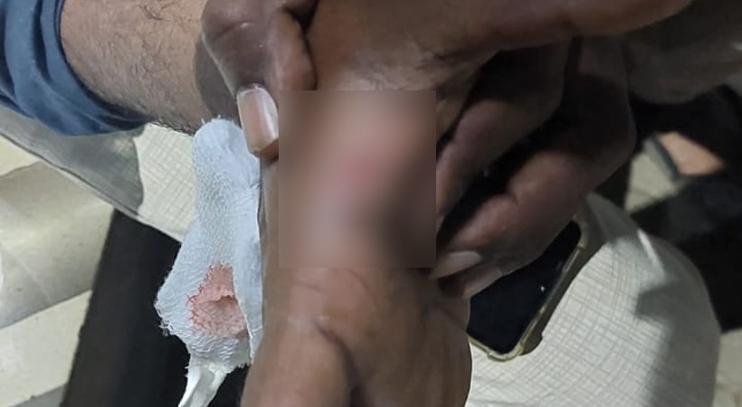 stray dog attack doctor