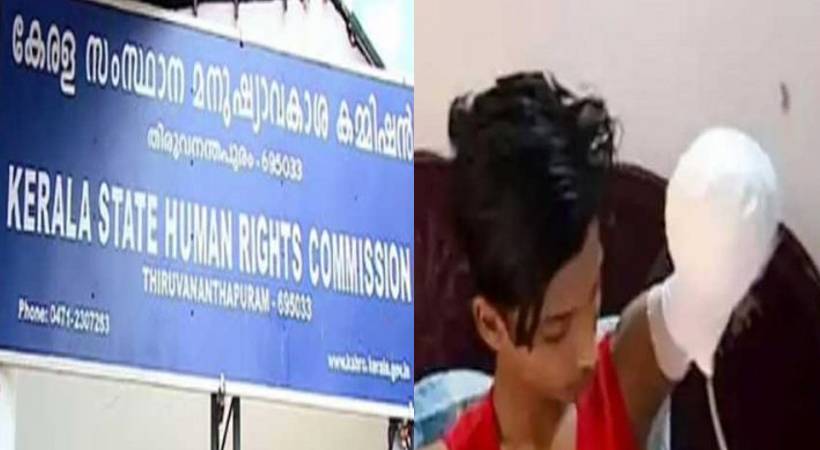 Human Rights Commission inquiry amputating student's hand