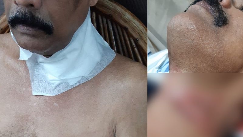 Bike rider injured after cable stuck around necks