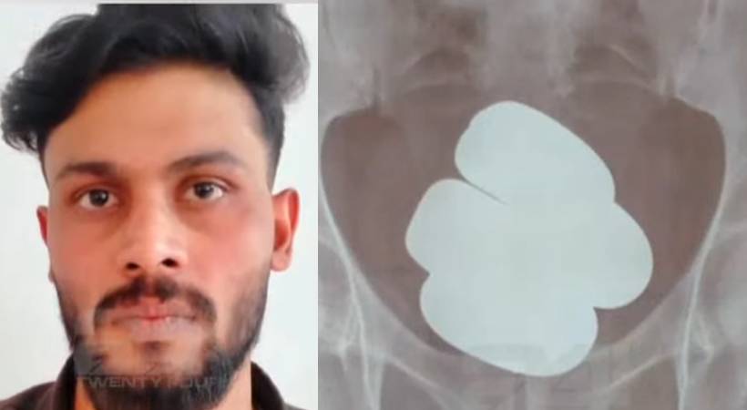 capsules containing gold mixture stomach; Accused in custody