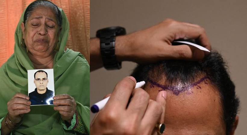 man dies after hair fixing gone wrong