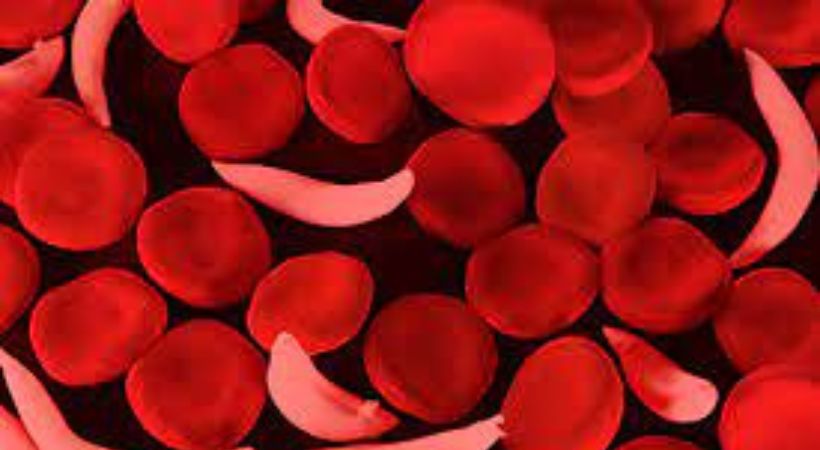 indian will be sickle cell anemia free by 2047