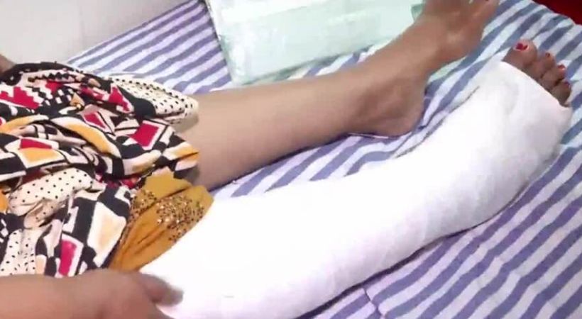 Sajna's family against police in leg replacement surgery case