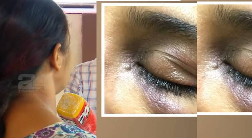 sexual attack against thriuvananthapuram woman