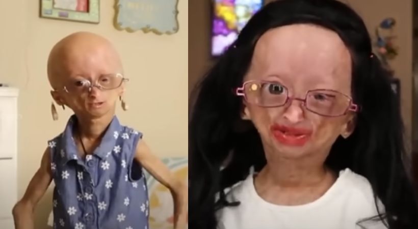 Adalia Rose Williams