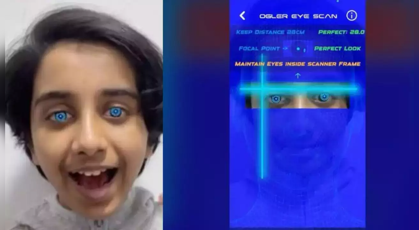 AI-based app detects eye diseases