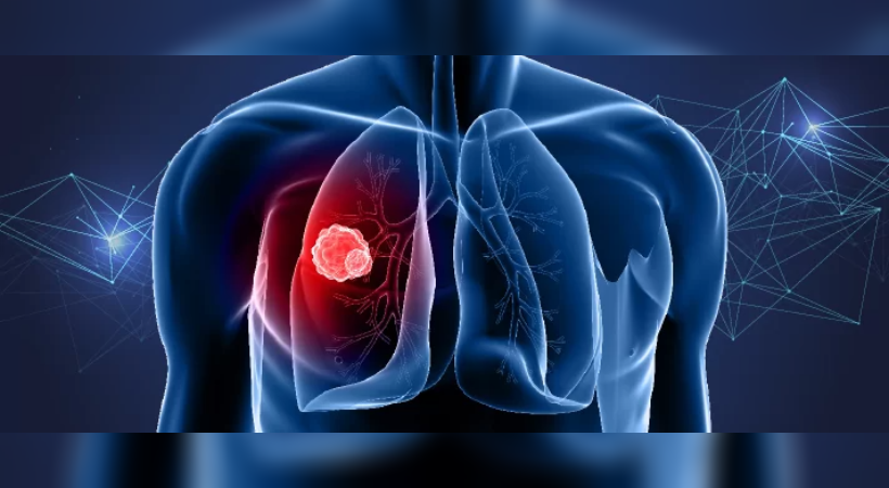reduction in the number of lung cancer patients