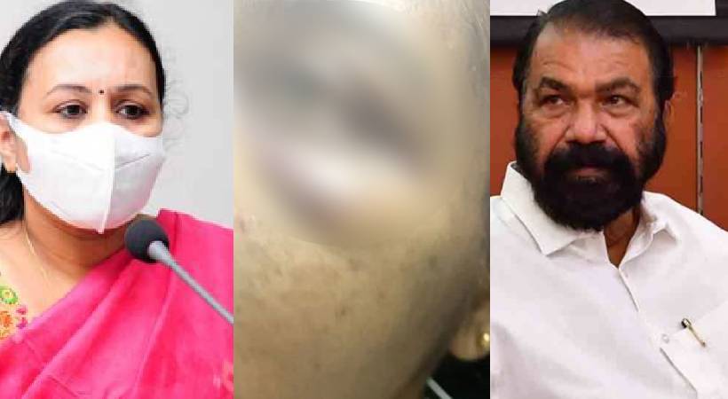 Attack on young woman in Petta Minister against police investigation