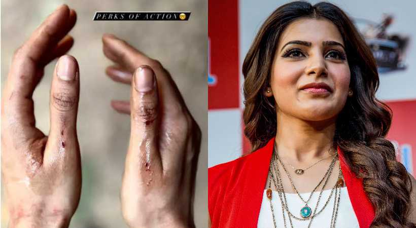 samantha injury