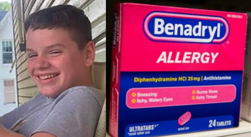 US Teen dies of benadryl challenge