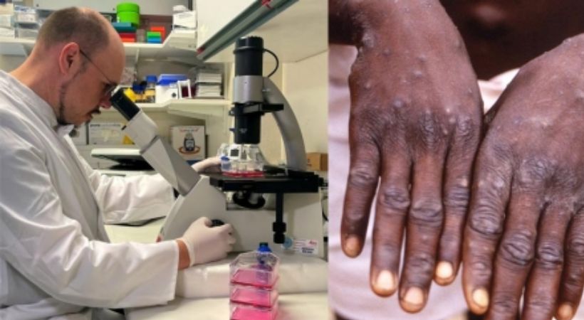 Mpox no longer a global emergency WHO says
