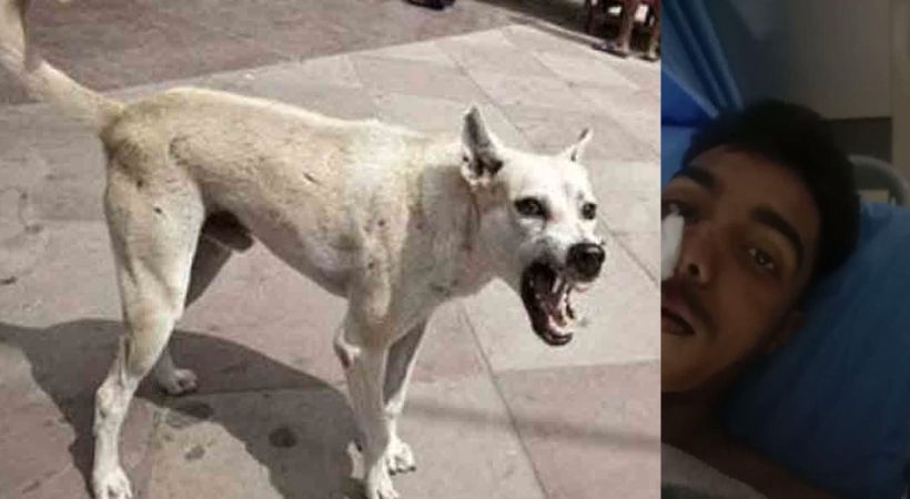 stray dog attack in Thrissur; Student injured
