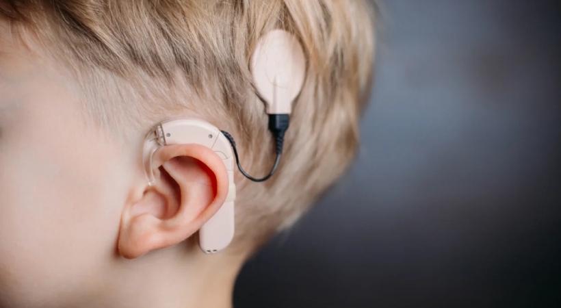 Funding for cochlear implantation upgradation