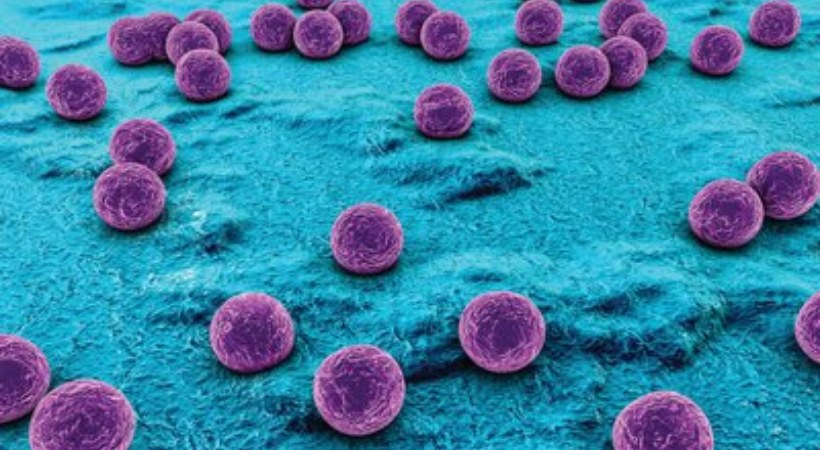 staphylococcus aureus bacteria may be the cause of death of old women